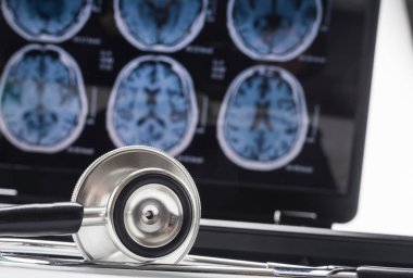 Hastanede Alzheimer hastalığının bilimsel analizi, kavramsal görüntü