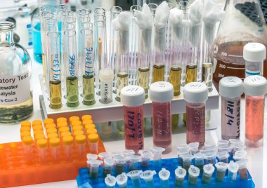 İçinde SARS-COV-2 Covid-19 örnekleri olan şişeler bir araştırma laboratuvarında, kavramsal görüntü