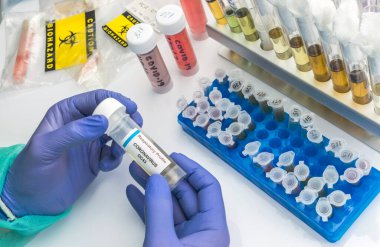 Bilim adamlarının elinde özel bir laboratuvar, kavramsal görüntüde Coronavirus OC43 numunesi bulunuyor.
