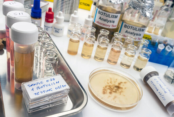 Образцы, загрязненные клостридиевым ботулиновым токсином, вызывающим ботулизм у человека, лабораторные исследования, концептуальное изображение
