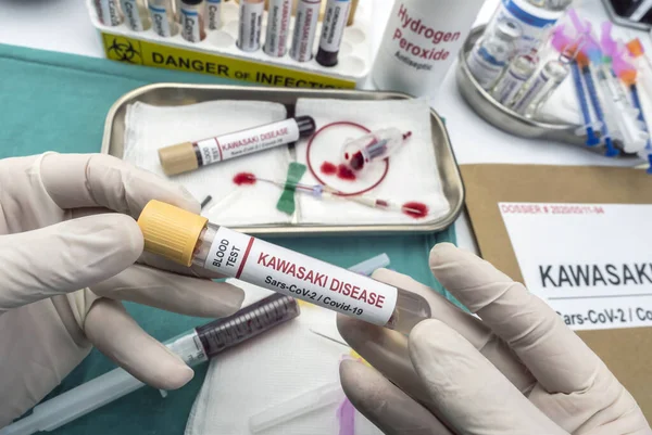 Enfermeira Detém Amostra Sangue Para Tratar Doença Kawasaki Relacionada Com Imagem De Stock