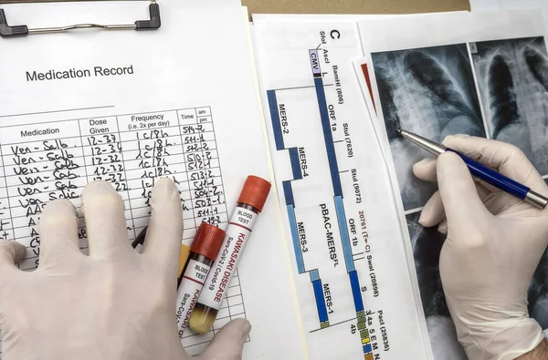 Lékař Detekuje Diagnózu Plíce Dítěte Postiženého Kawasakiho Chorobou Několika Krevními — Stock fotografie