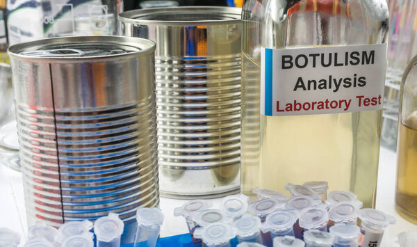 Образцы, загрязненные клостридиевым ботулиновым токсином, вызывающим ботулизм у человека, лабораторные исследования, концептуальное изображение
