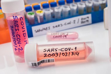 SARS-COV-1 örneklerinin bulunduğu şişeler, Sars-CoV-2 Covid-19 üzerinde yapılan bir laboratuvar epiedomolojik çalışmada soğuk olarak hazırlanmıştır.