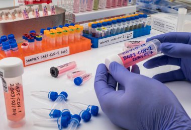 SARS-COV-1 örneklerinin bulunduğu şişeler, Sars-CoV-2 Covid-19 üzerinde yapılan bir laboratuvar epiedomolojik çalışmada soğuk olarak hazırlanmıştır.