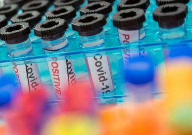 İçinde SARS-COV-2 Covid-19 örnekleri olan şişeler bir araştırma laboratuvarında, kavramsal görüntü