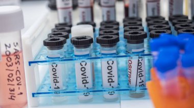 SARS-COV-1 örneklerinin bulunduğu şişeler, Sars-CoV-2 Covid-19 üzerinde yapılan bir laboratuvar epiedomolojik çalışmada soğuk olarak hazırlanmıştır.
