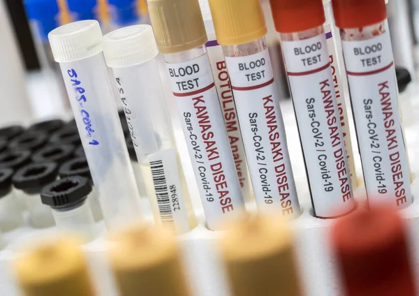 Blood Samples Treat Sars Cov Related Kawasaki Disease Children Five — Stock Photo, Image