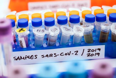 İçinde SARS-COV-2 Covid-19 örnekleri olan şişeler bir araştırma laboratuvarında, kavramsal görüntü