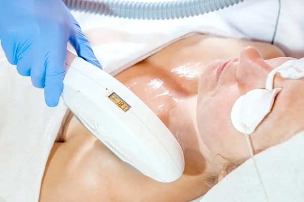 laser skin treatment