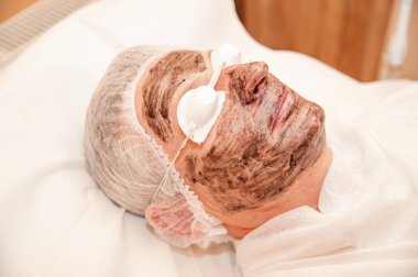 karbon lazer tedavisi cilt / lazer tedavisi