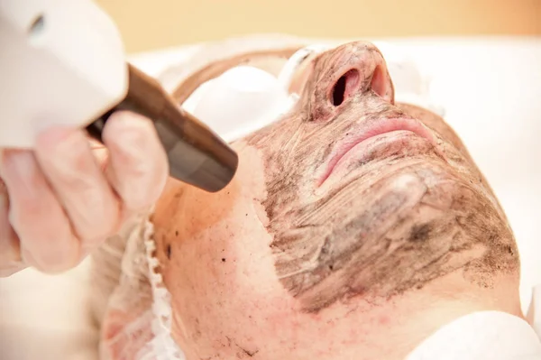 karbon lazer tedavisi cilt / lazer tedavisi