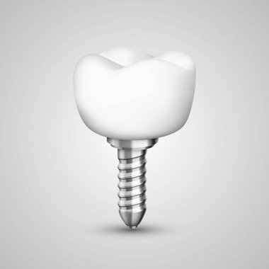 Siyah arka planda diş implantı.