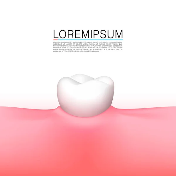 Зуб в челюсть, покрытие на белом фоне . — стоковый вектор