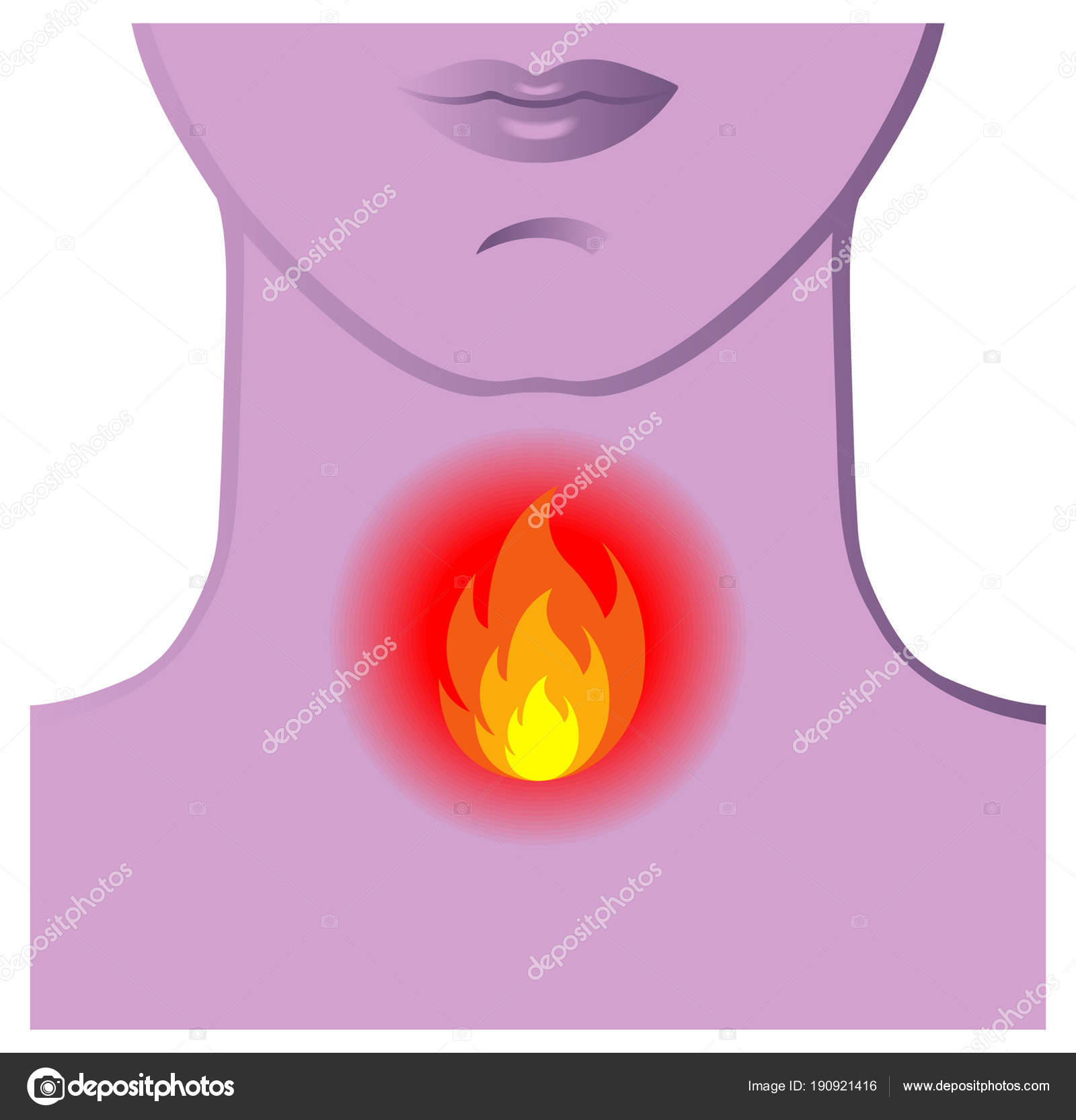 ベクトル図を燃焼と人間 ストックベクター ©rob3000 190921416, image size:1600x1666