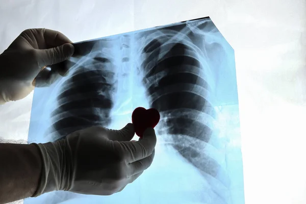 Las manos del médico sostienen un corazón de juguete cerca de una radiografía de los pulmones — Foto de Stock