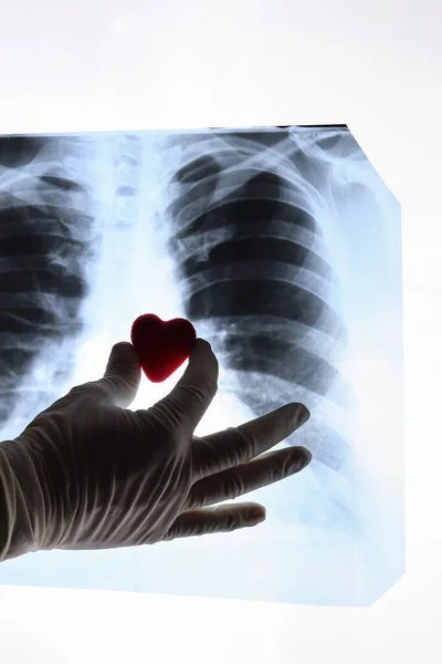 Las manos del médico sostienen un corazón de juguete cerca de una radiografía de los pulmones — Foto de Stock