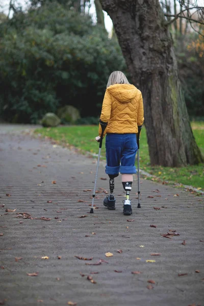 Bacakları olmayan bir kız protezlere biner.