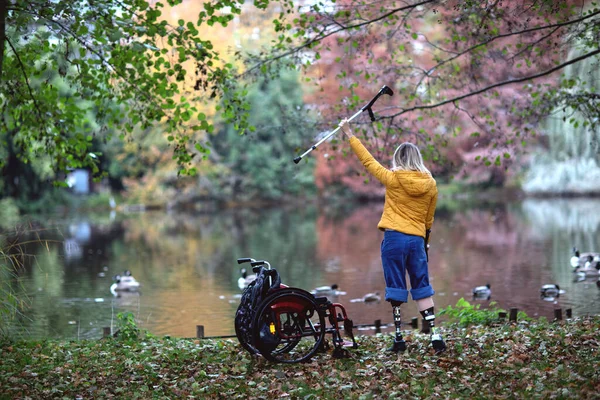 Bacakları olmayan engelli bir kadın ilk kez protez taktırdı.. — Stok fotoğraf