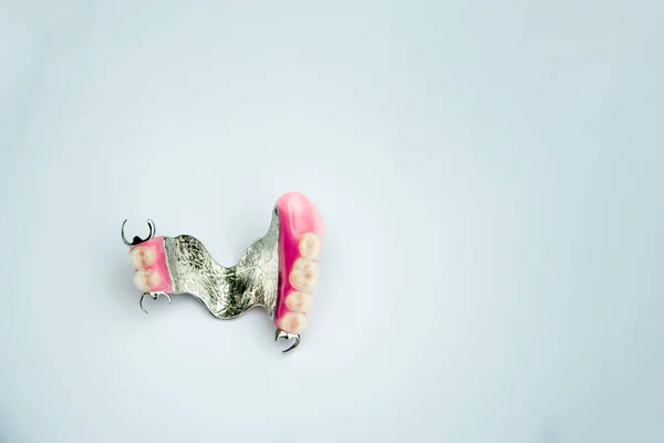 Metal takma diş. Kemer protezleri. Takma diş. Üst midye çıkarılabilir takma dişler — Stok fotoğraf