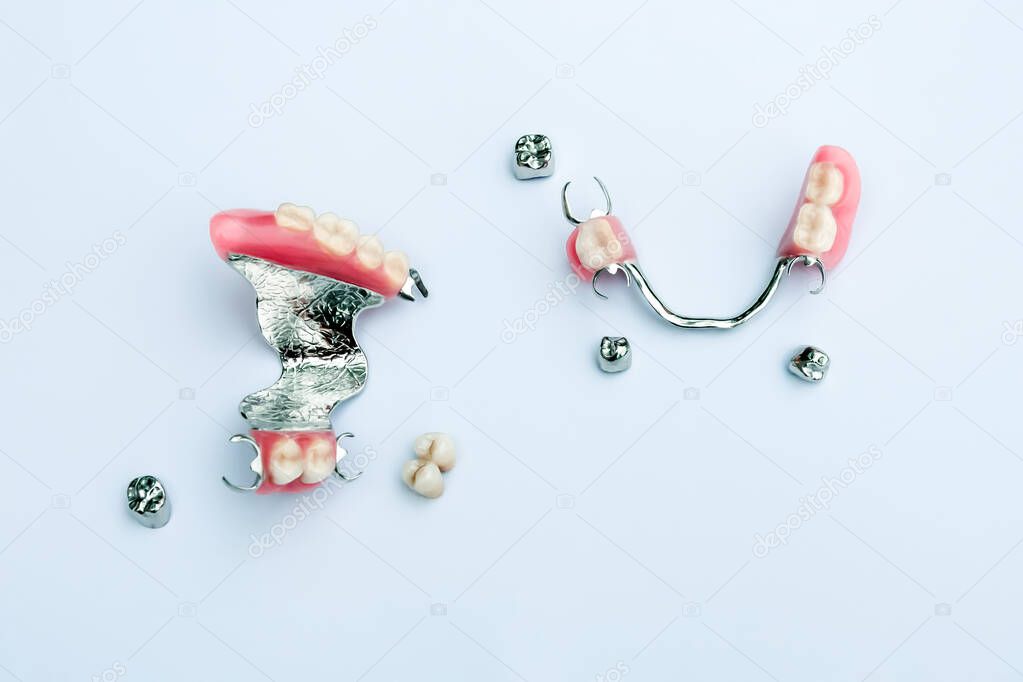 a set of removable clasp prostheses with ceramic-metal crowns on the upper and lower jaws. dental prosthetics concept. concept of orthopedic dentistry