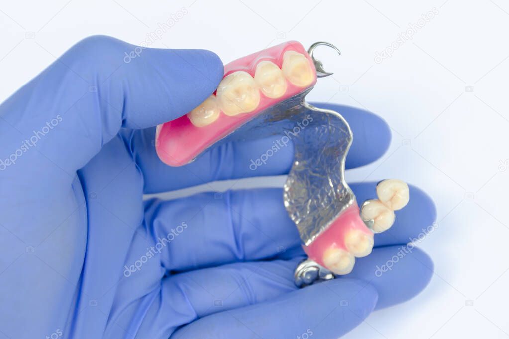 upper denture in the hands of a dentist. blue glove. clasp prosthesis. false teeth. ceramic-metal crowns