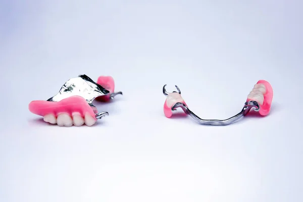 Taçlı takma dişler. Diş protezleri. Dişçilik. Kayıp dişlerin yenisi. Metal protezler. Bir dizi takma diş. — Stok fotoğraf