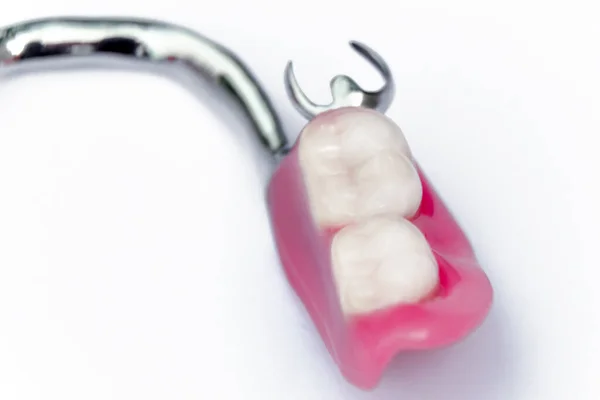 Conceito de odontologia ortopédica. próteses dentárias. prótese da mandíbula inferior removível. pinça de fixação. contexto — Fotografia de Stock