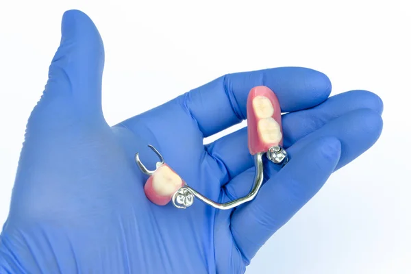 Ортопедична стоматологія. знімні протези. протезування застібками — стокове фото