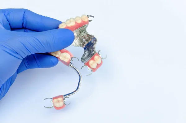Odontología ortopédica. concepto de prótesis extraíble —  Fotos de Stock