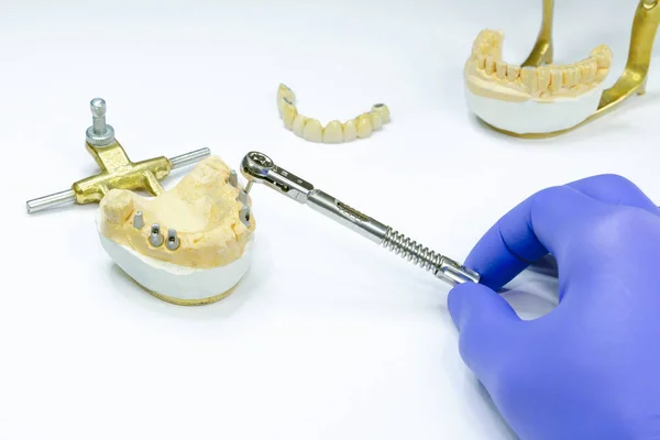 El dentista desenrosca el implante con una llave. prótesis de implantes. producción de coronas sobre implantes. implantación dental —  Fotos de Stock