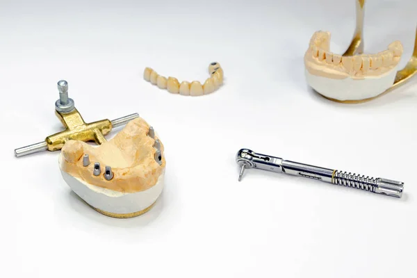 ortopedik dişçilik. Yapay diş yapıyorlar. Diş implantasyonu. Protezleri yerleştir. ışık arkaplanı
