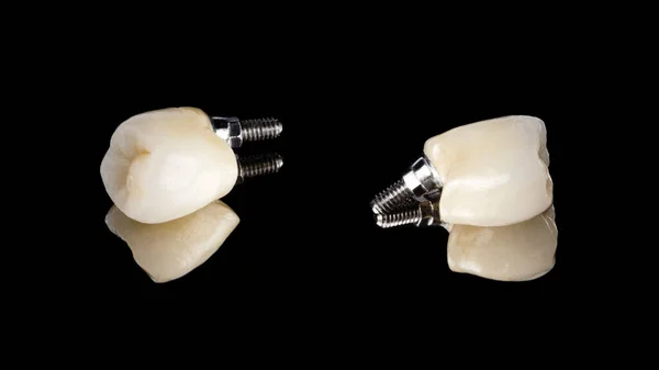 İmplantta diş seramik azı dişi kaplaması var. Farklı taraflardan görünüyor, siyah bir arkaplanda izole edilmiş. yapay insan dişi. implant protez konsepti