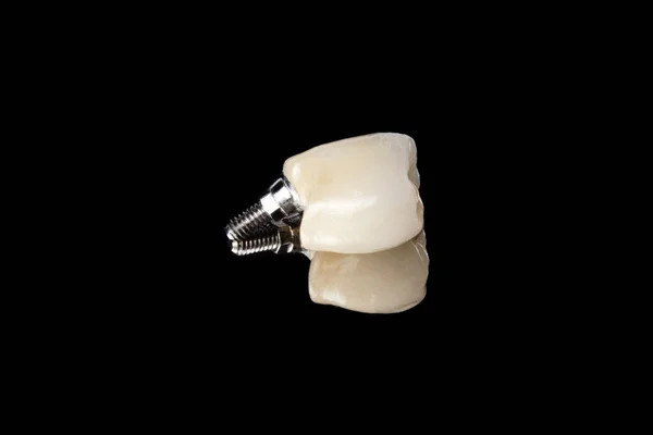 Керамический Зуб Черном Фоне Отражением Керамическая Коронка Фиксацией Зубном Имплантате — стоковое фото