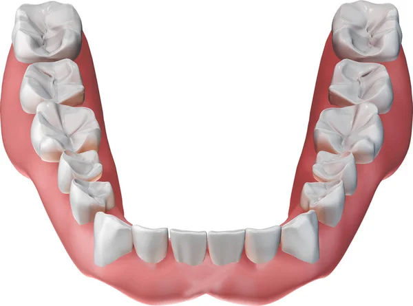 Знімні Нижні Зубні Протези Ізольовані Білому Тлі Ілюстрація — стокове фото