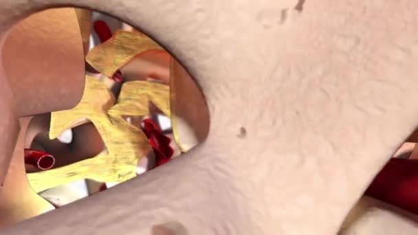 Caméra voler dans l'os de l'éponge au-dessus du vaisseau rouge de santé et montre les parois du trou après le forage de la procédure osseuse avec les vaisseaux sanguins qui ont détruit. Vue microscopique. Animation 3D. Fichier MP4. 20 secondes .