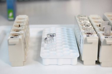 Tıbbi araştırmalar için kovanlarda test tüpleri. Doğru teşhisi koyma kavramı. Üst görünüm.