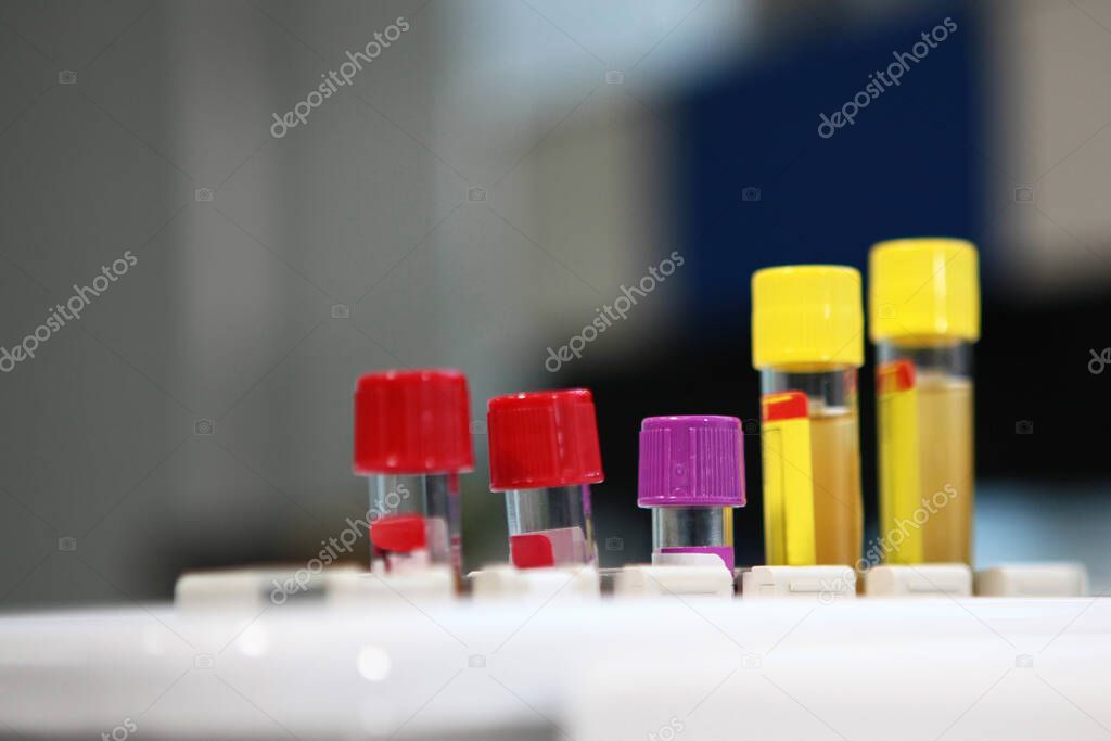 Several types of tubes stand on a stand in a laboratory. Life saving concept. Macro photo. Copy space.