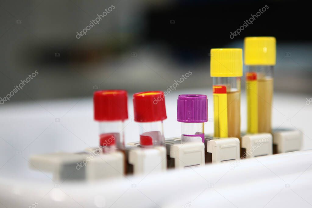 Several types of tubes stand on a stand in a laboratory. Life saving concept. Macro photo. Copy space.