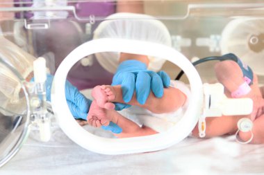 Üç günlük yeni doğmuş bebek, yoğun bakım ünitesinde, bir tıbbi inkübatörde. Doktorun el ve bacaklarının makro fotoğrafı. Yeni doğan kurtarma konsepti. Diriltme doktorlarının işi..