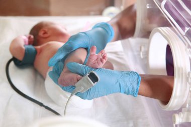 Üç günlük yeni doğmuş bebek, yoğun bakım ünitesinde, bir tıbbi inkübatörde. Doktorun el ve bacaklarının makro fotoğrafı. Yeni doğan kurtarma konsepti. Diriltme doktorlarının işi..
