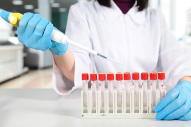 Pipetli koruyucu eldivenli laboratuvar asistanı. Tıbbi araştırma. Koronavirüs tehdidi. Uzayı kopyala Üst görünüm