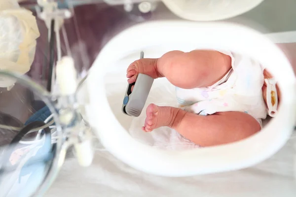 抢救重症监护下的新生儿 一个带医疗设备的孩子的腿的宏观照片 拯救生命的概念 照片在室内 — 图库照片