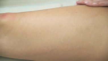 Bir kadın için selülit önleyici vakum masajı