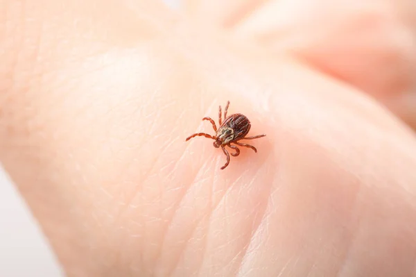 Mite Human Body Close Concept Need Examine Body Walking Habitat Stock Image