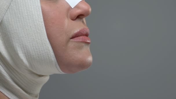 Вид на лицо женщины с эластичной повязкой, реабилитация после пластической операции — стоковое видео