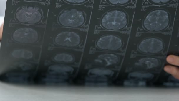 Médico anciano analizando tomografía cerebral y temblor de cabeza, tumor incurable — Vídeos de Stock