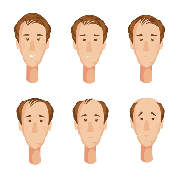 Balding Man Heads Set — Stock Vector