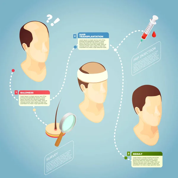 Ilustracja wektorowa transplantacji włosów — Wektor stockowy
