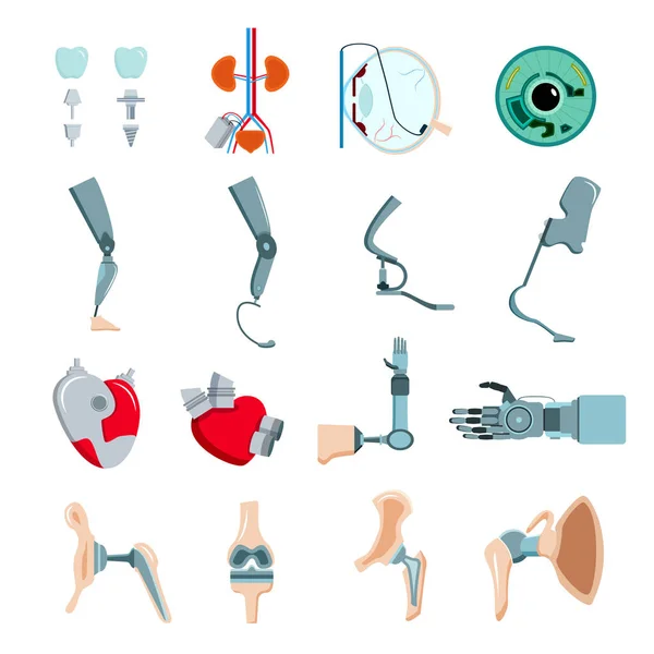 Prothesis implantaten platte Set — Stockvector